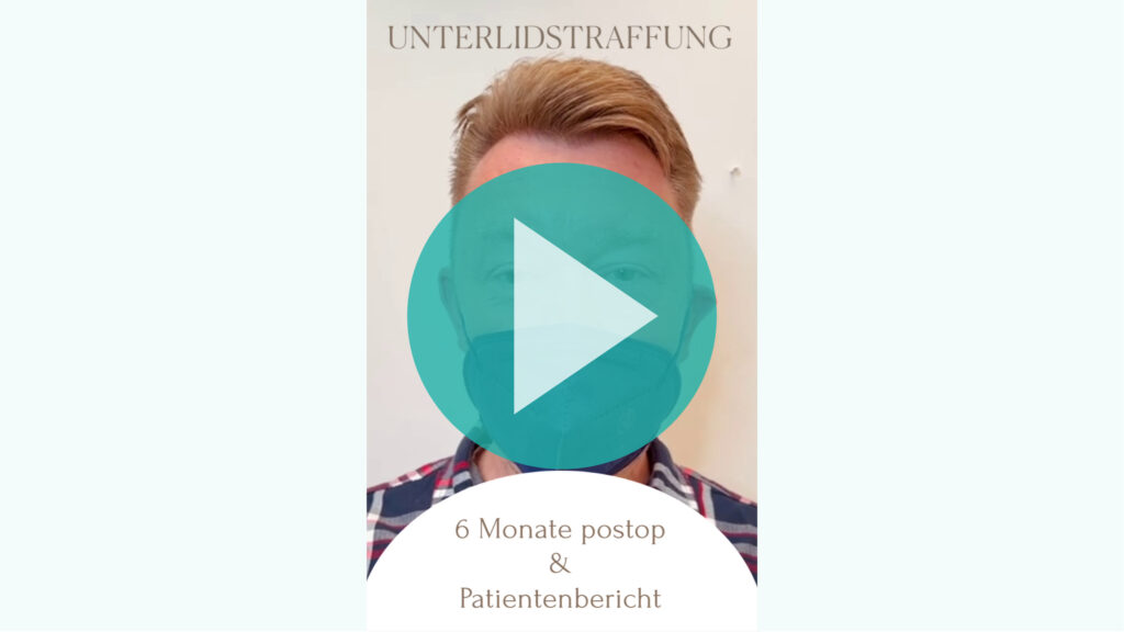 YouTube Video Platzhalter Happy Patient Story: Natürliches Ergebnis nach Unterlidplastik bei ausgeprägten Tränensäcken